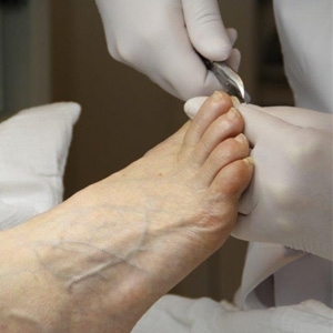 pedicure